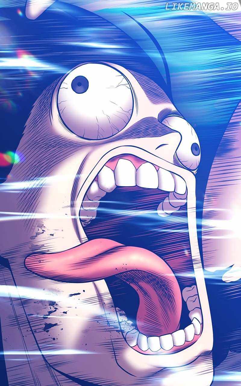 151