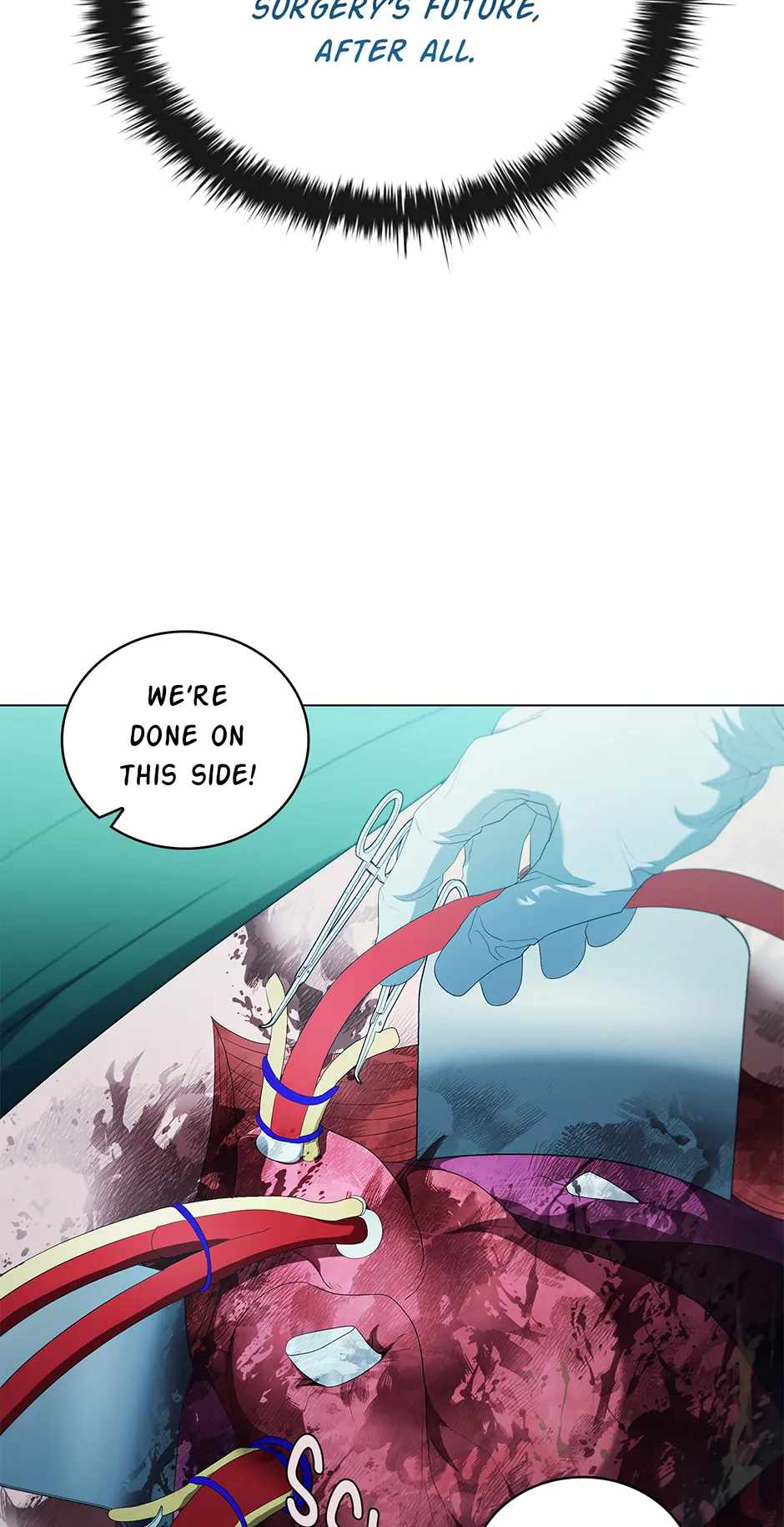 45