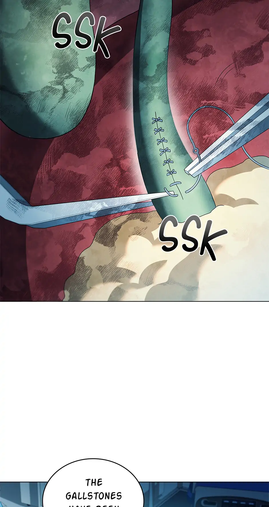 39