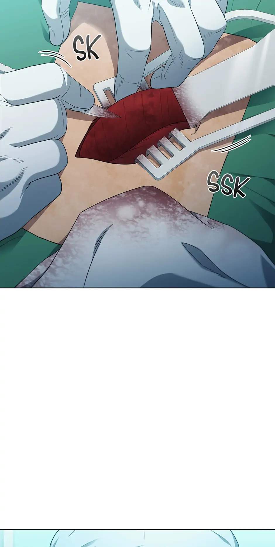 49