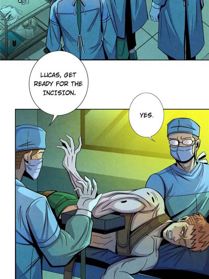 35
