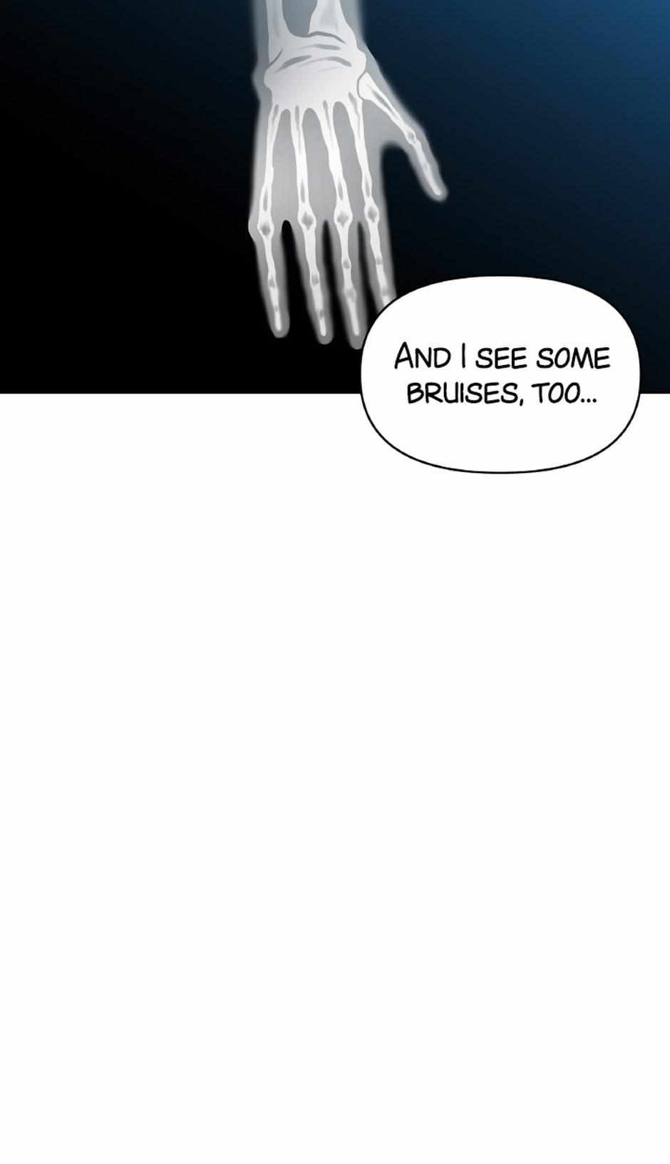 87