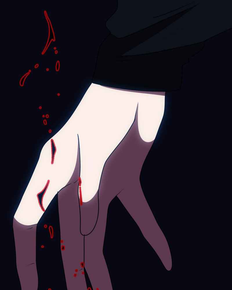 31