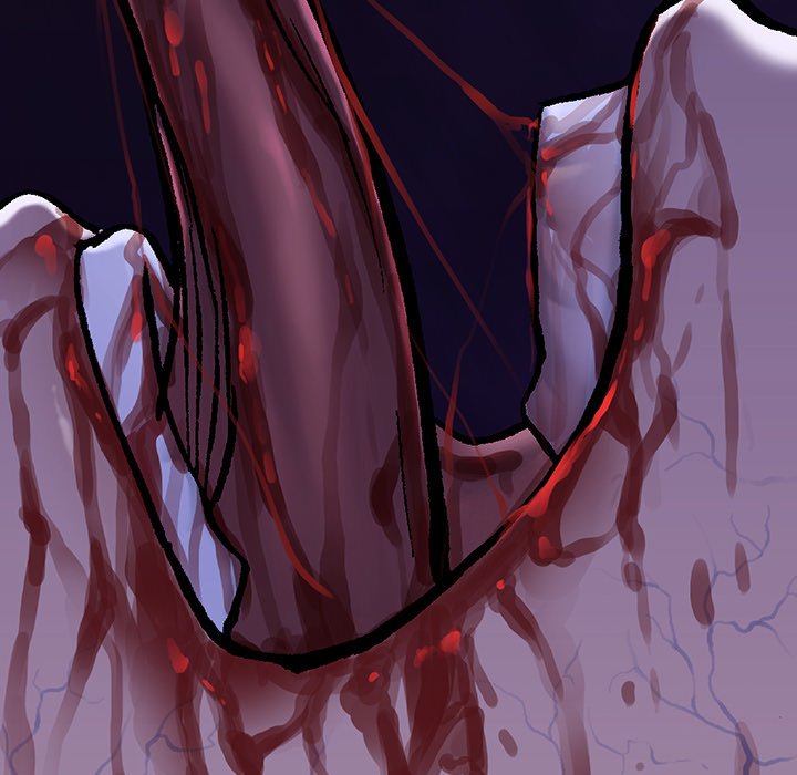 72