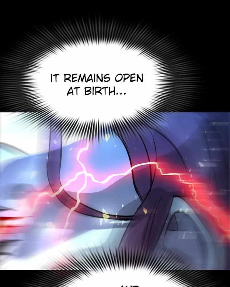 99