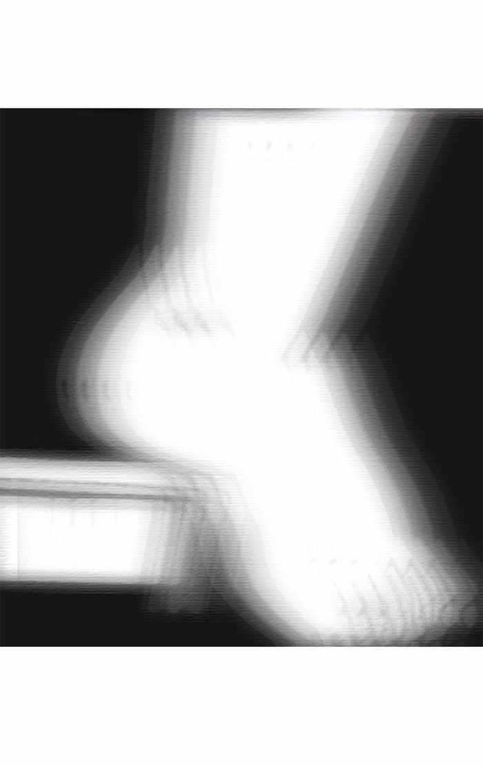 65