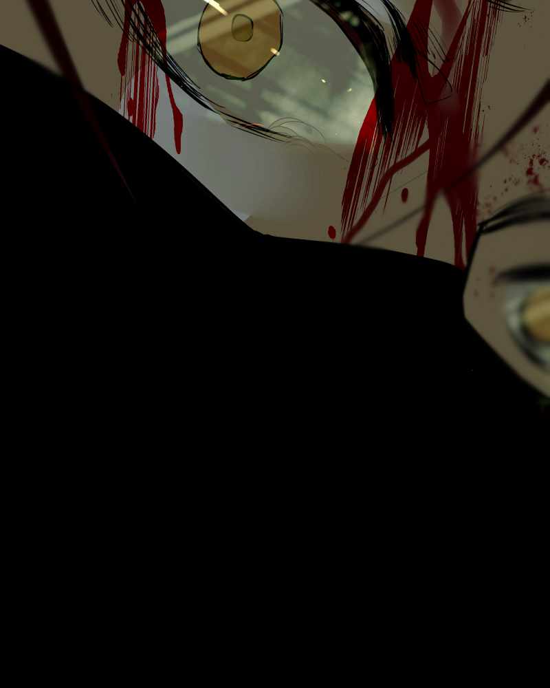 151