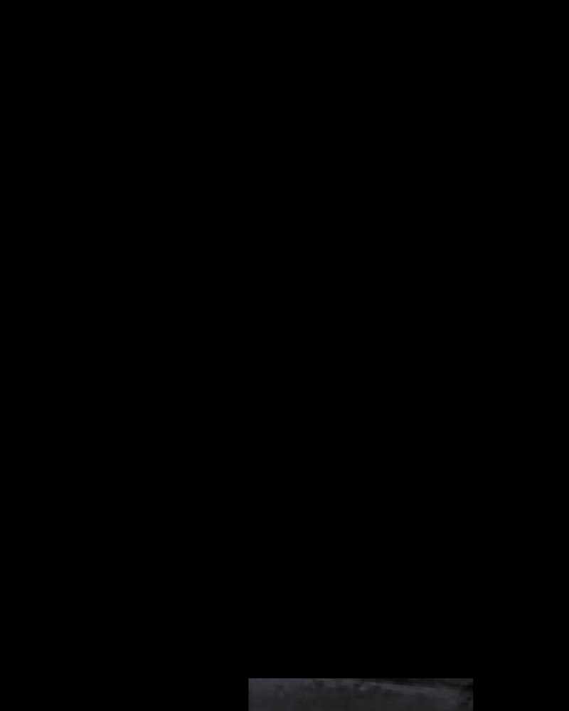 199