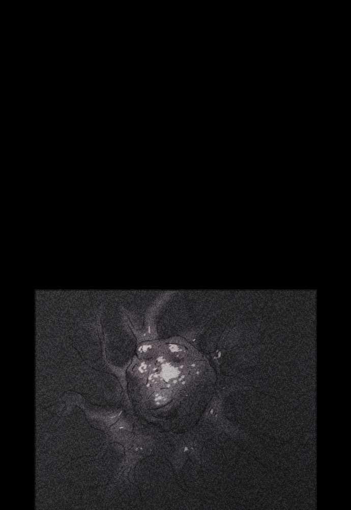 69
