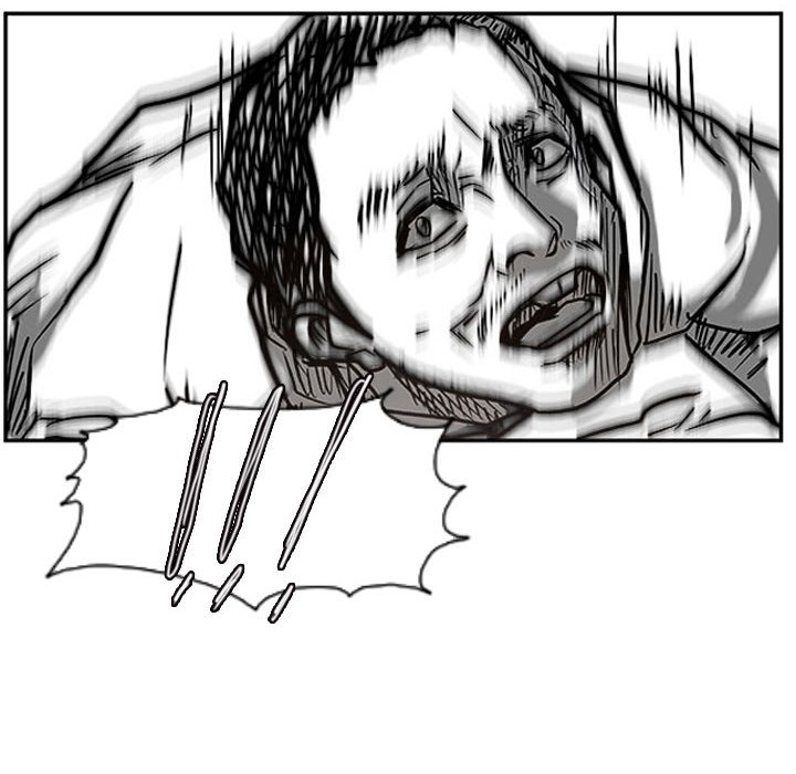 99